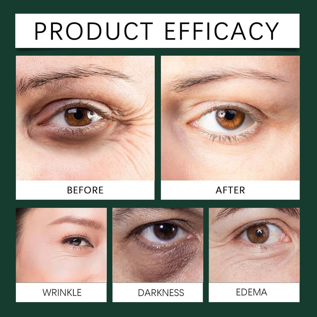 Ouhoe Mint Flavored Eye Repair Roller Essence Hydrating Wrinkle Reducing Formula For Youthful Skin