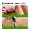 MANTING Mite Removal Nourishing Soap