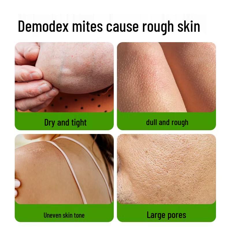 MANTING Mite Removal Nourishing Soap