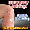 Leg Eczema Relief – Soothes Leg Eczema: Stops Itch, Repairs Dry Leg Skin. Light, Quick-absorbing