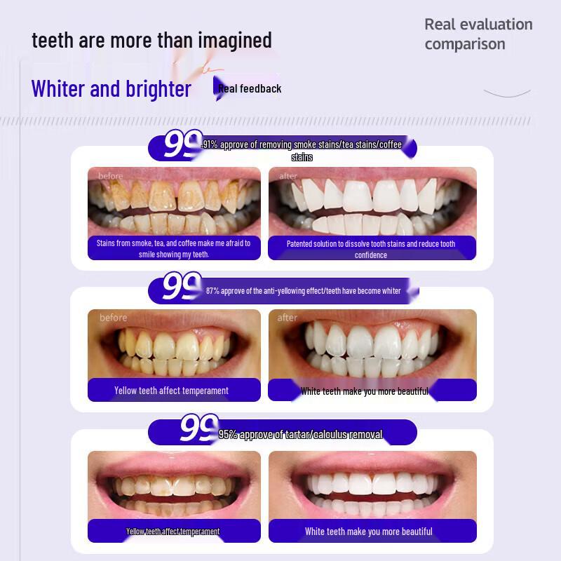 HIEUAILR Whitening & Stain Removal Toothpaste