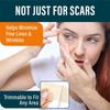 Silicone Scar Tape for Scars Professional Tape Reusable Removal Sheet C-section Burns Acne Keloids, etc., 1.5" x 120