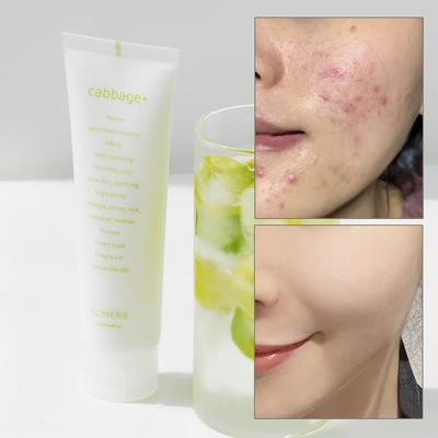 Cabbage Acne Functional Baha Mildly Acidic Foam Cleansing 120ml, 1 Piece