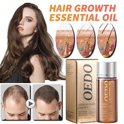 Natural Hair Growth Oil - Stimulate Hair Growth and Prevent Hair Loss