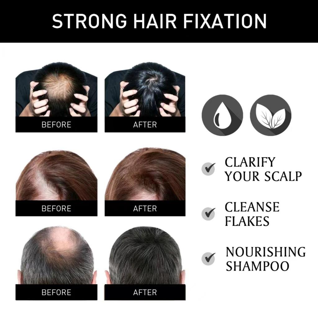 5% Minoxidil Biotin Hair Serum For Men And Women Dense Hair Serum Healthy Hair Penetrates Root To Tip