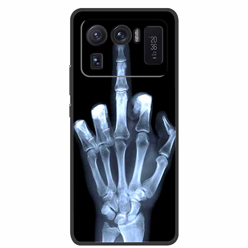For Xiaomi Mi 11 Ultra Case 6.81 Shockproof Soft silicone TPU Back Cover Cases For Xiaomi11 Ultra Phone fundas Mi11 Ultra Cute
