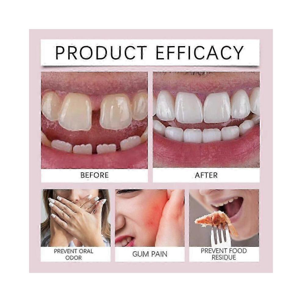 Cushion Grip Thermoplastic Denture Adhesive, Refits and Tightens Loose Upper and Lower Dentures and Partials | Non-Glue Adhesive