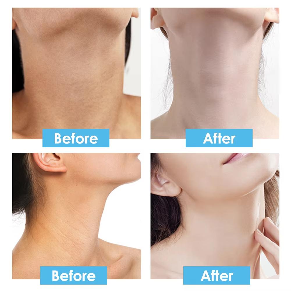 1/5/10 st Getmjölk Nackmask Kollagen Uppstramande Anti-Rynkle Whitening Anti-aging Mask Skönhet Fuktgivande Lift Uppstramande Nacke Hudvård