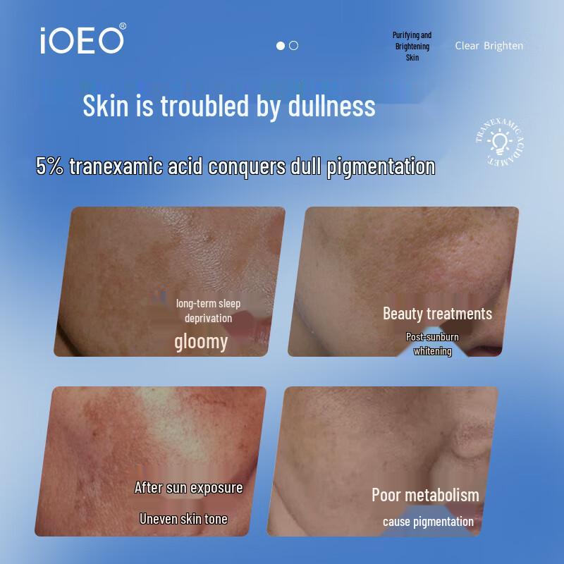 Tranexamic Acid 5% Dark Spot Correcting Essence