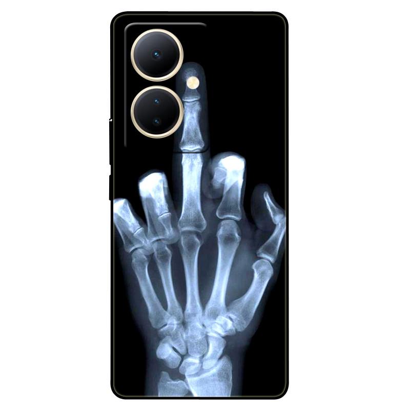 For Vivo V29 Lite 5G Case Global TPU Silicone Wolf Lions Phone Shell For VIVO V29 LITE 6.78 Funda On V29Lite Cat Animals Covers
