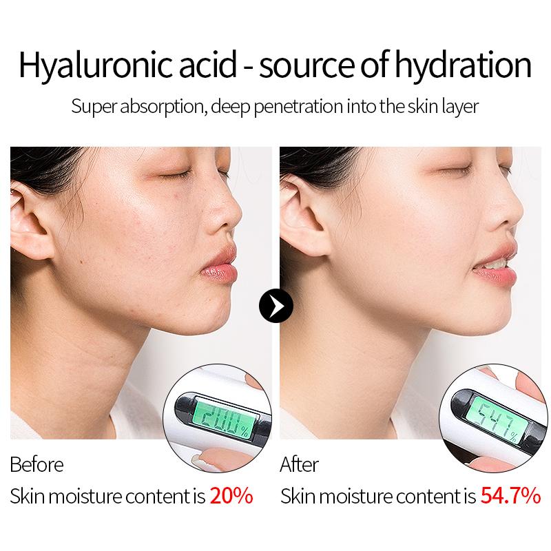 15ml Hyaluronic Acid Facial Serum Whitening, Anti-Wrinkle & Firming Skin Care Products