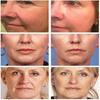 Rynkborttagare Ansiktsserum Lyftande Anti-aging Reducera Fina Linjer Återfuktande Essens