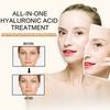 Hyaluronic Acid Anti-Aging Serum Lightens Dark Circles, Wrinkles, Firms and Brightens Skin