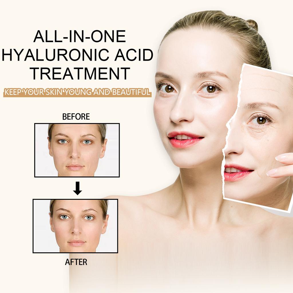 Hyaluronic Acid Anti-Aging Serum Lightens Dark Circles, Wrinkles, Firms and Brightens Skin