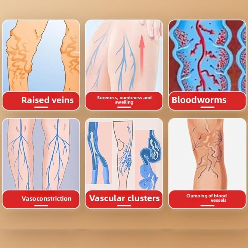 Varicose Veins Cream - Relief for Leg Swelling & Pain, Improves Blood Circulation, Thai Herbal Formula, External Care Ointment 55g