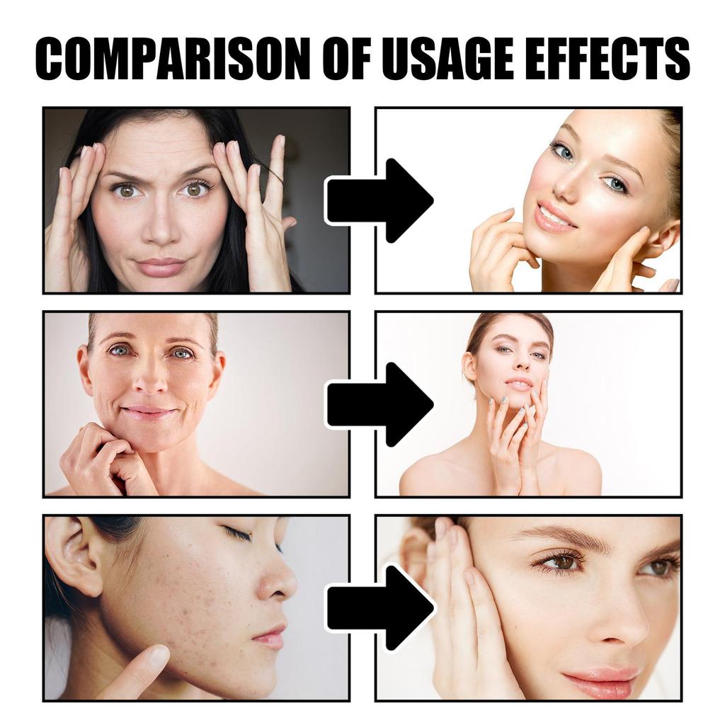 EELHOE Dragon's Blood Anti-Wrinkle Cream 30g, Reduces Wrinkles, Moisturizes, Firms, Brightens Skin Tone, Anti-aging Cream Essence