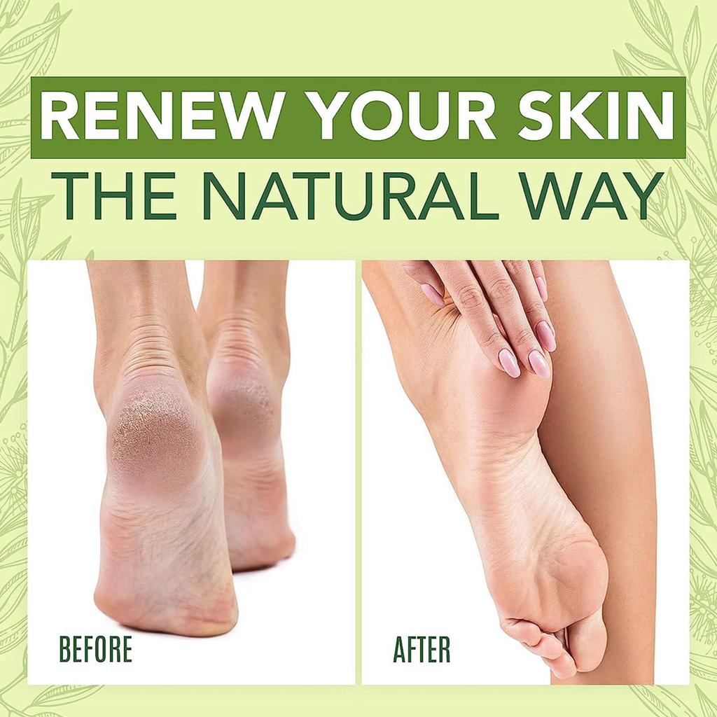 Groene Thee Voetcrème - Hydraterend & Herstellend, Voetverzorging & Lichaam, Huidverzachtende Crème - Eczeem, Ringworm, Droogheid