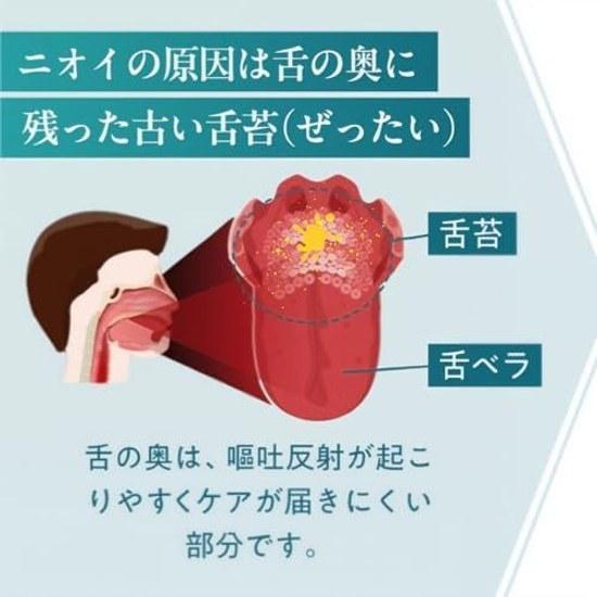 Ivankool Tongue Cleaner Wide Type Coating Removal Brush Polishing Bad Breath Care Zero Gag Reflex Vacuum Stainless Steel High Quality Made Korea 10000