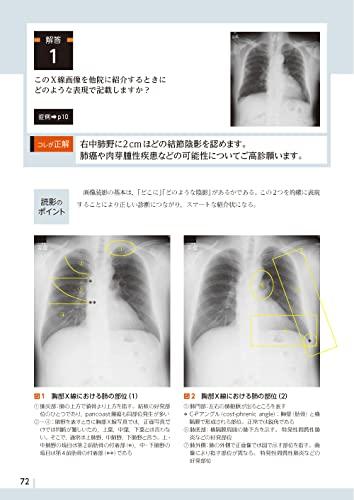 Diagnostic Imaging Dojo Updated Edition <Chest Edition>
