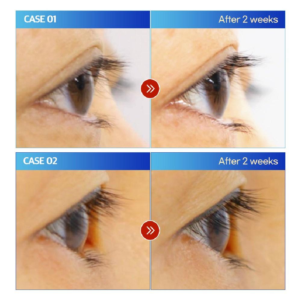 Sunny Pop Eye Bambi Long Lash Serum, Vegan Certified, 2-week Completion, Hypoallergenic Eyelash Nutrition, Extension Eyebrow Care, 2 Pieces, 10ml