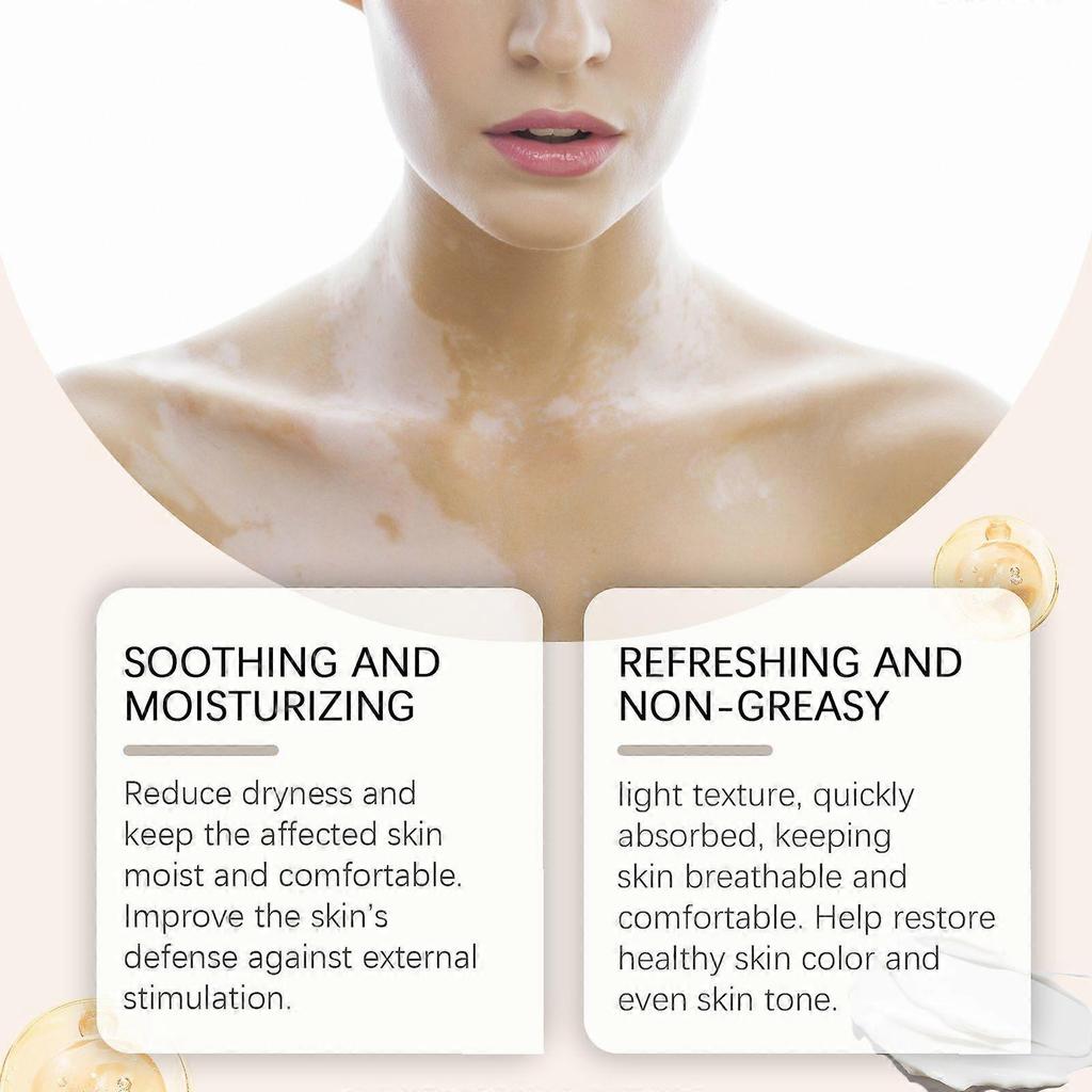 2025 Latest Model  Body Care Cream, Relieve Itching And Swelling Of Hands And