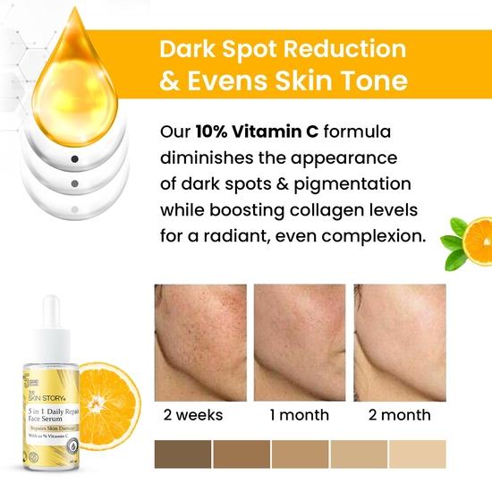 The Skin Story Vitamin C Face Serum 10% | 5-in-1 Daily Face Repair | Enriched with Hyaluronic Acid & Mulberry | Suitable for All Skin Types (40ml)