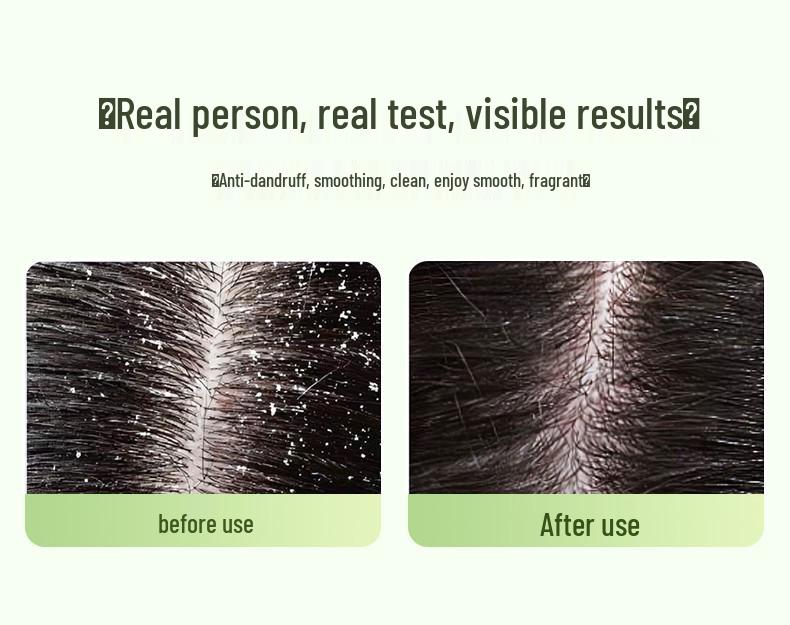 Biqiao Anti-Dandruff Smoothing Shampoo - Fragrant, Smooth Hair for the Whole Family