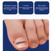 12/10Pcs Ingrown Toenail Treatment Kit Multi-Sized Titanium Alloy Nail Corrector Tools for Curved Toenails