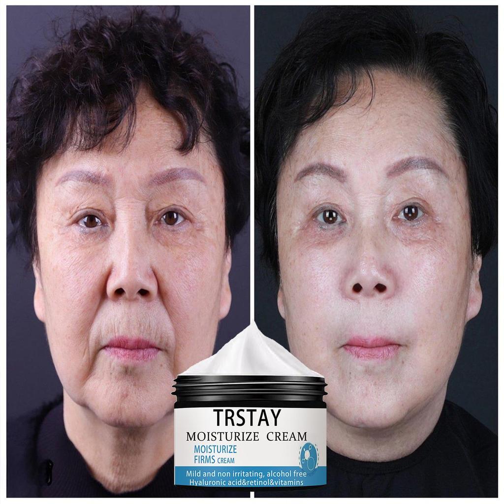Face Cream Anti-Aging Wrinkles Ingredient Exfoliating Shrink Pores Anti-Oxidation Lift Firming Remove Fine Lines
