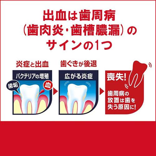 [ ] Camtect Gum Care Periodontal Disease (Gingivitis and Pyorrhea) Prevention Set (2 Bottles)