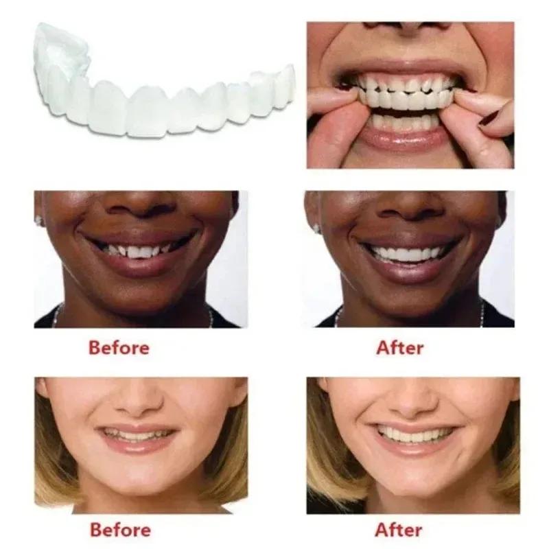 15pairs Perfect Fit Teeth Whitening Fake Tooth Cover Snap on Silicone Smile Veneers Teeth Flexibles Fake Teeth Dental Whitening