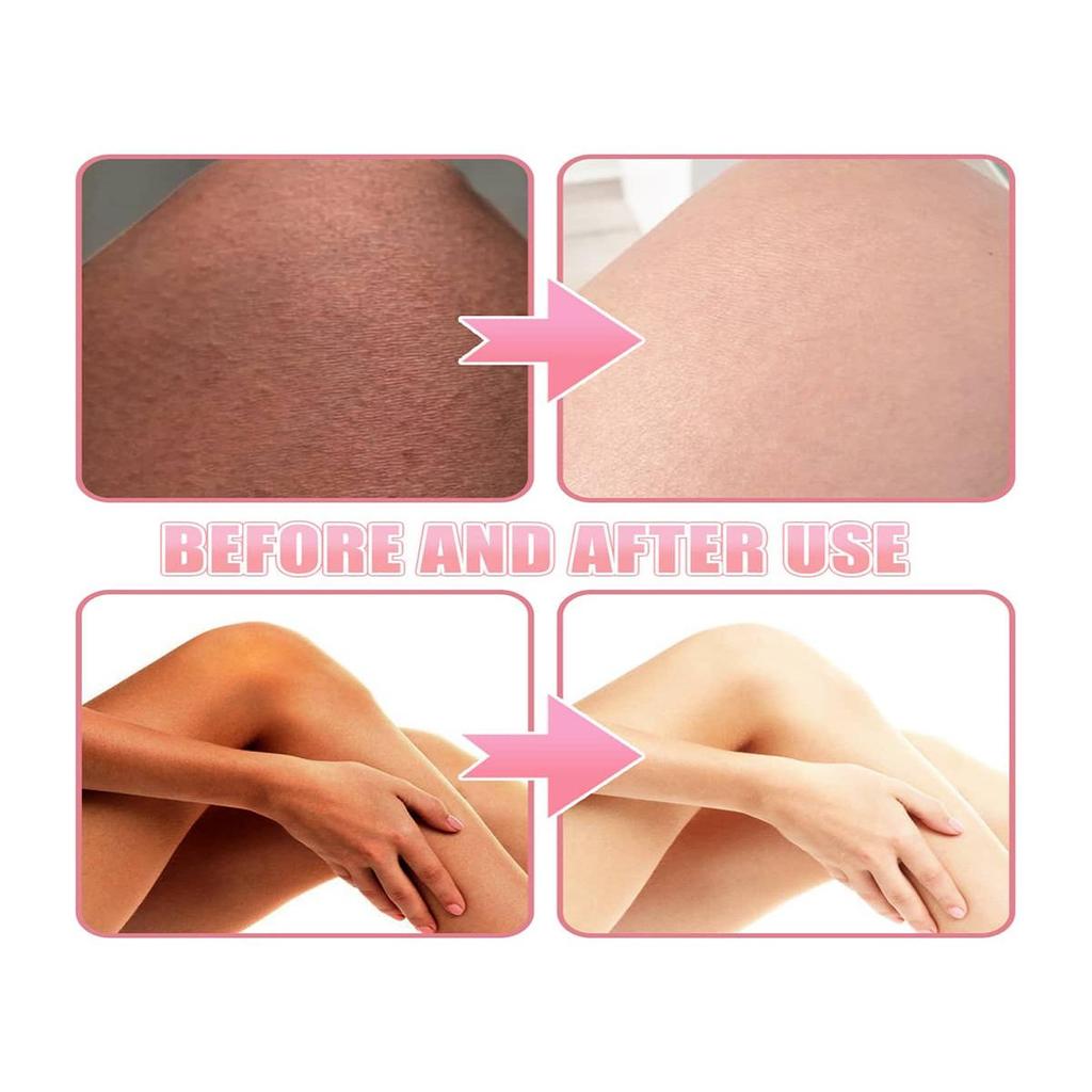 The Skin Cream Moisturizes, Nourishes and Brightens the Skin. Body Lotions and Brightening Creams To Reduce Dull Skin