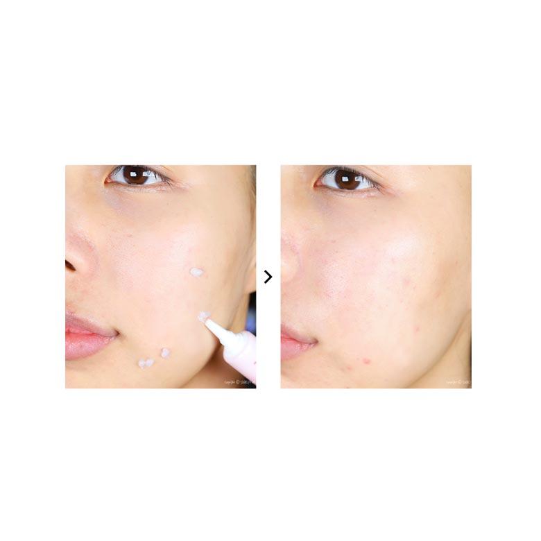 Dr.Orga La Forlab Centellascar Ointment(Basil) 15g