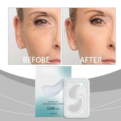 Microneedle Firming Eye Patches Moisturize Eye Bags, Dark Circles, Reduce Fine Lines, Anti-wrinkle, Firming Eye Patches Remove Eye Wrinkles