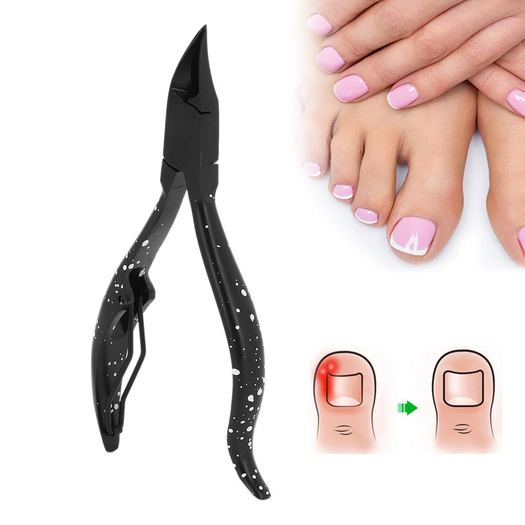 Nagelhautschneider Zehennagelknipser Pediküre Nagelhautentferner Werkzeuge für eingewachsene Zehennägel