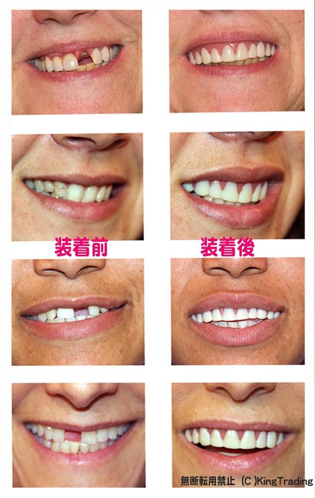 Zâmbet Instant Mărime M Articol Unic (Zâmbet Instantaneu)