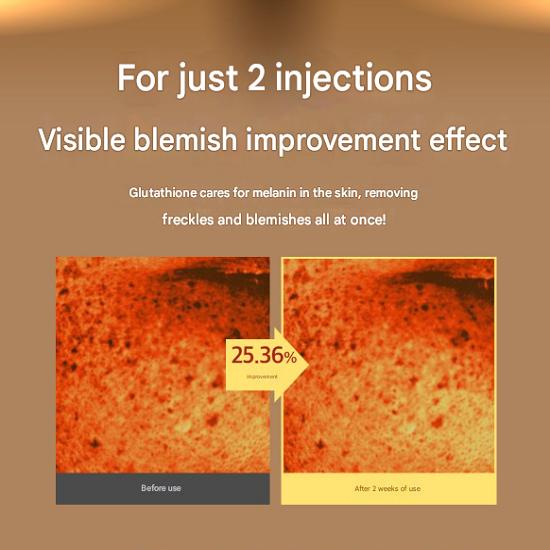 Glutathione freckle cream pigmentation blemishes age spots freckles moisture regeneration moisturizing whitening cream, 50ml, 1 piece
