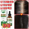 100% Rosemary Oil Hair Loss Essence, Scalp Essence Ampoule Hair Serum Nourishing Supplement Hair Loss Pr Ion Hair, 30ml