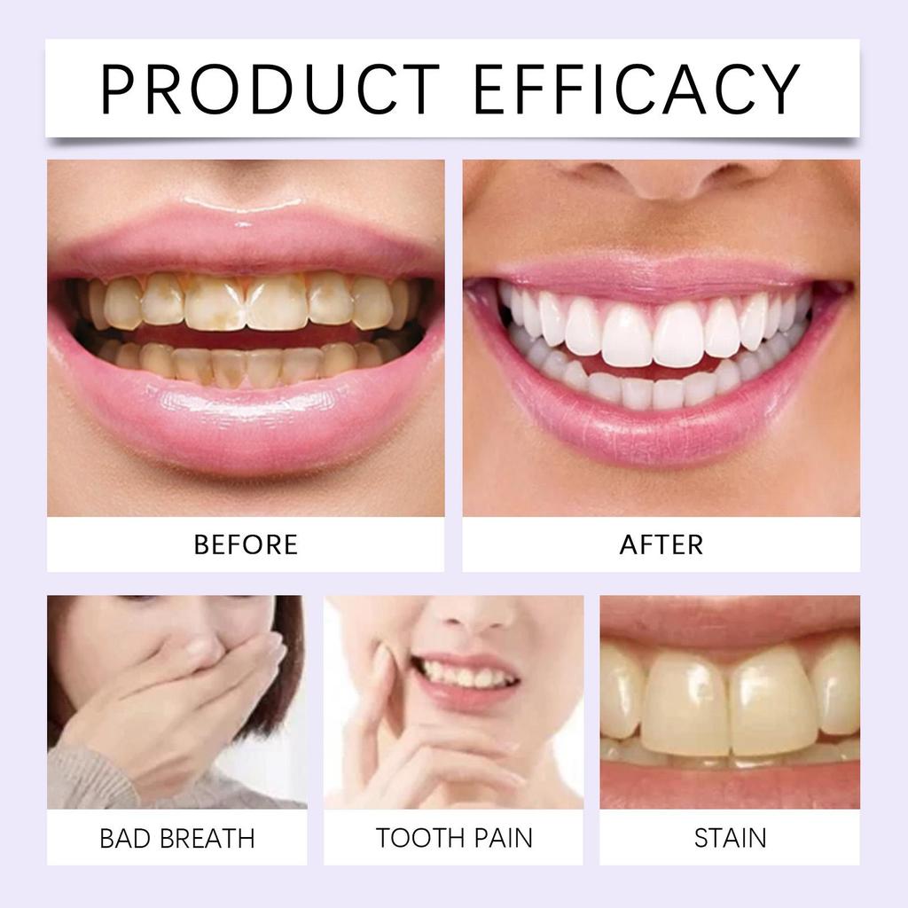 Purple Teeth Whitening Strips Brighten Tooth Remove Plaque Stain Cleaning Oral Hygiene Reduce Sensitivity Bleaching Dental Tools