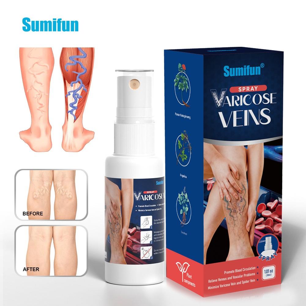Venous Care Spray Reduces Vascular Protrusions and Smooths Out Varicose Veins the Legs and Throughout the Body.