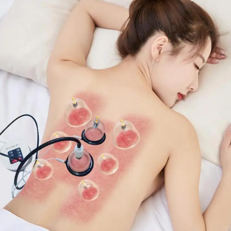 Electric Cupping Device Household Multi-Cup Meridian Suction & Dredging System Electric Scraping Cupping Massage Tool