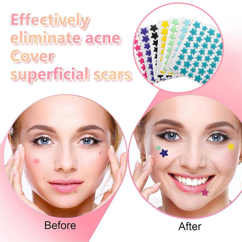 36/40 Pcs Repair Acne Patch Facial Skin Care Fade Blemishes Pimple Marks Closed Acne Blemishes Cover Acne Pimple Repair Patch
