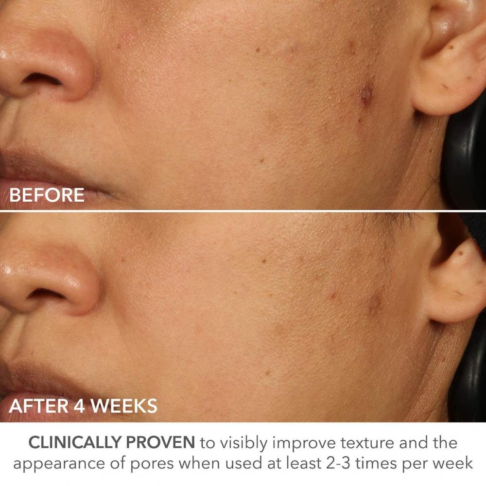 DR. Dennis Gross Skincare Advanced Retinol + Ferulic 0,5 Extra Stärke 8er-Pack