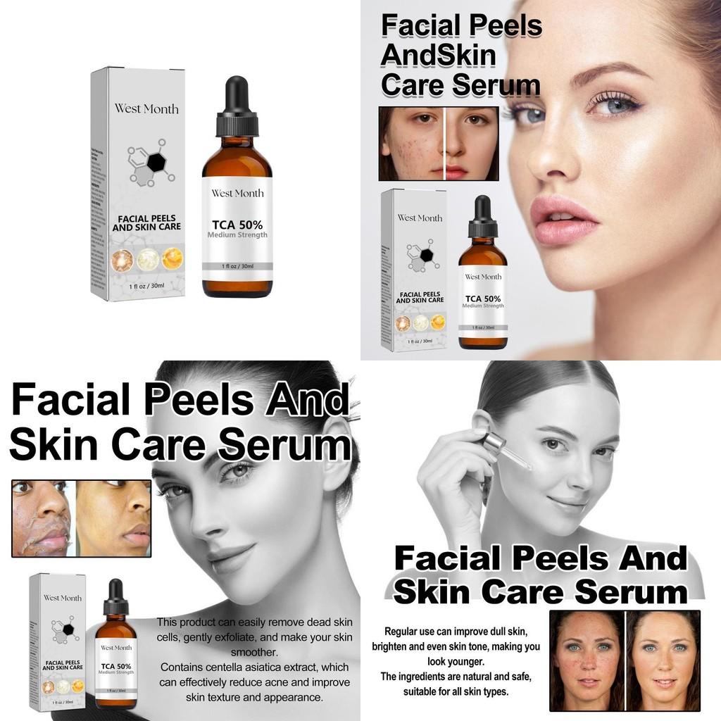 West Month Anti-acne Repair Serum For Diminishing Dark Spots And Cleansing Skin Imperfections