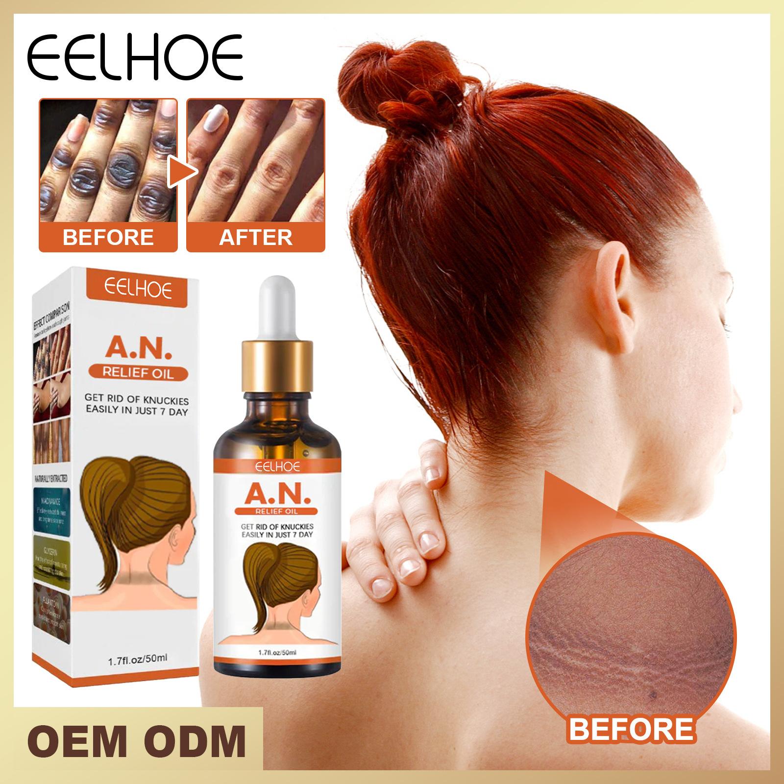 

EELHOE 50 мл Отбеливающая сыворотка от темных костяшек пальцев Осветляющая сыворотка от темных коленей и локтей Крем от темных пятен Масло для тела Осветляющий меланин Уход за телом