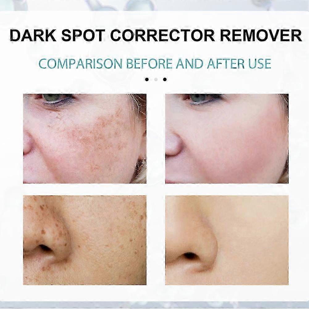 Correttore Schiarimento Macchie Viso Antirughe Illuminante Crema!ZZ37
