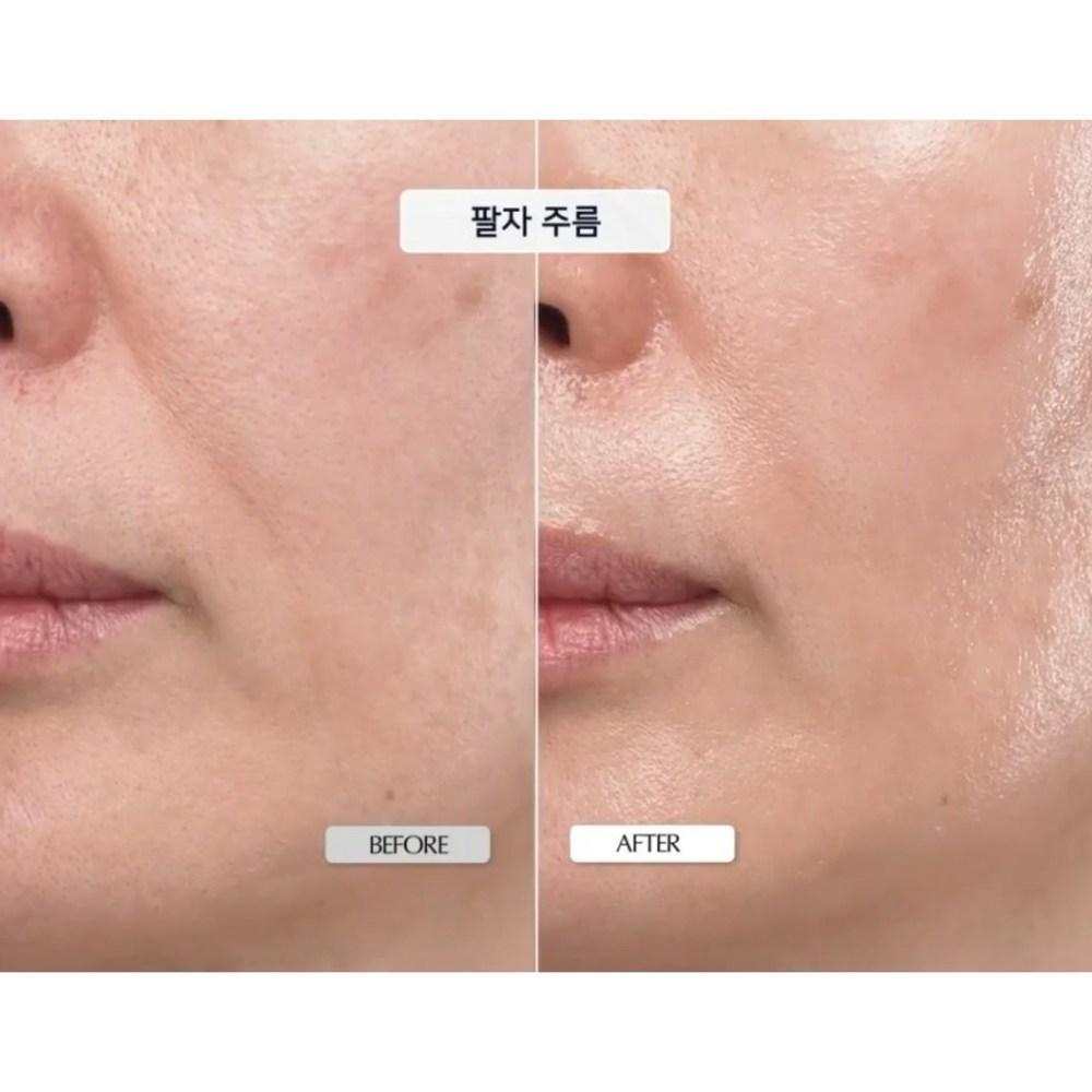kopher Feuchtigkeitsspendende Barriere Strahlende Elastizität Melder SOS System 1,5 ml*20 Stück(30ml)