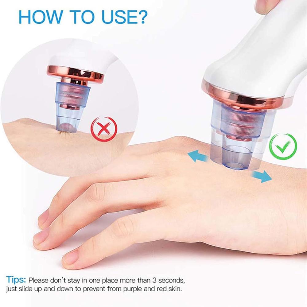 USB Rechargeable Pore Cleanser 3 Suction Levels Blackhead Extractor with 5 Heads Skin Care Tool