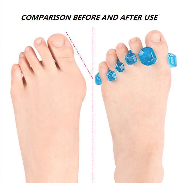 Gel Toe Stretcher & Separator - Soft Bunion Relief, Hammer Toe Corrector (S/M/L Size), Sold as Pair