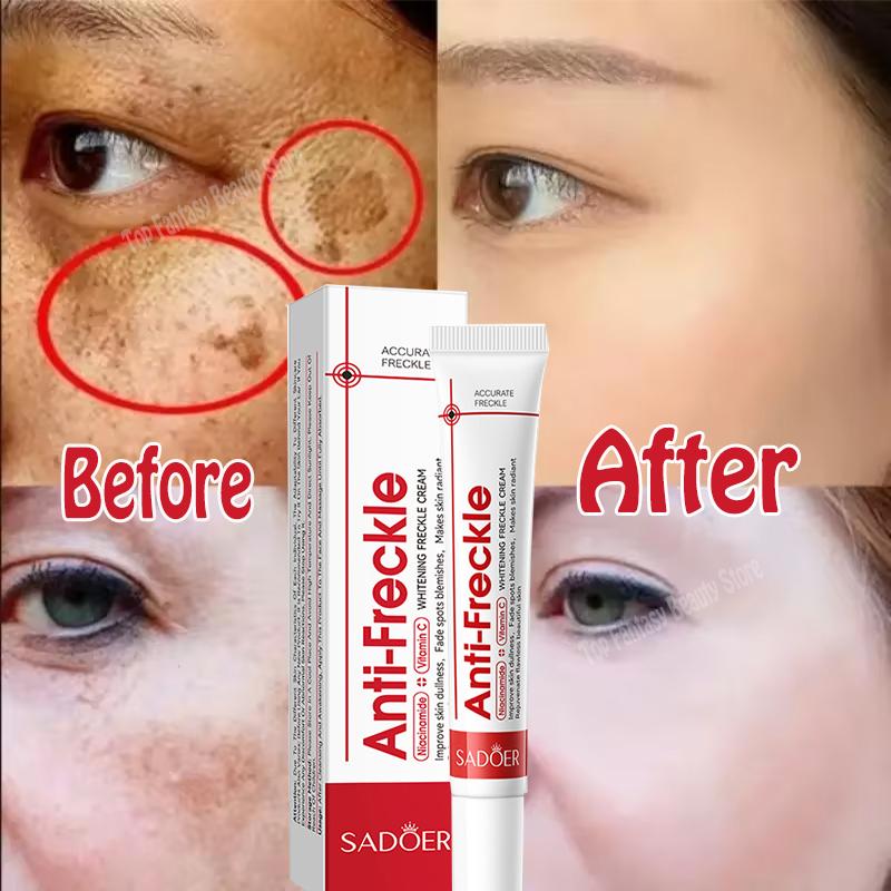 Crème blanchissante puissante anti-taches Éclaircit la peau rapidement Élimine la pigmentation mélanique Mélasma Taches brunes Soin de la peau coréen